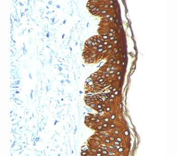 IHC: FFPE skin stained with Basic Cytokeratin antibody AE3.