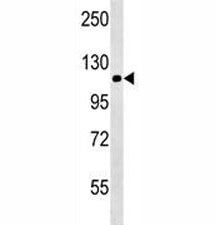 NALP12 Antibody (NLRP12)