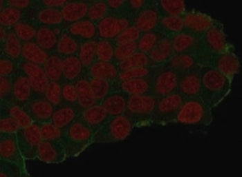 Immunofluorescent staining of PFA-fixed human MCF7 cells that have been transfected with an HA-tagge