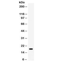 Western blot testing of human MCF7 cell lysate with GADD45A antibody. Expected molecular weight: 14-
