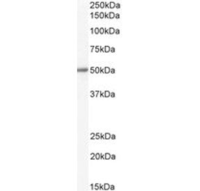 ALDH1B1 Antibody