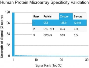 CKB Antibody / Creatine kinase B