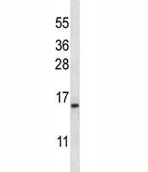 BAFF Receptor Antibody