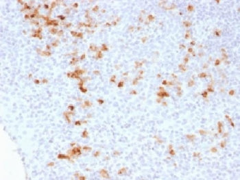 Kappa Light Chain Antibody
