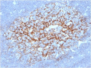 IHC staining of FFPE human lymph node with CD23 antibody (clone FCER2/6891) at 2ug/ml in PBS for 30m