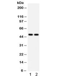 Western blot testing of human 1) MCF7 and 2) 293 cell lysate with SOX4 antibody. Expected/observed m