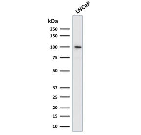 Folate Hydrolase 1 Antibody / FOLH1 / PSMA