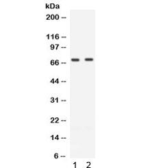 Western blot testing of human 1) Jurkat and 2) CEM cell lysate with ZAP70 antibody. Expected molecul