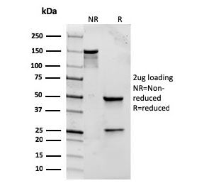 SDS-PAGE analysis of purified, BSA-free recombinant TLR2 antibody (clone rTLR2/221) as confirmation 