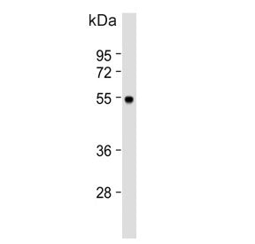 MCH Receptor 1 Antibody / MCHR1