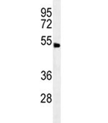 ABHD8 Antibody