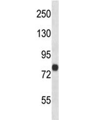 ACSL4 Antibody / FACL4