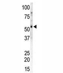 CAMK2G Antibody