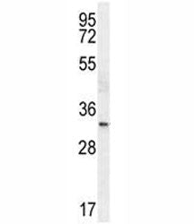 NKX2.1 Antibody (TTF1)