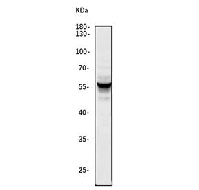 Western blot testing of human HepG2 cell lysate with TGF-beta receptor type-1 antibody. Predicted mo