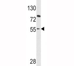 PAX8 Antibody