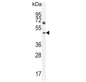 C12orf29 Antibody