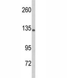C5 Antibody