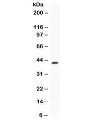 Western blot testing of mouse spleen lysate with Factor D antibody. Predicted molecular weight ~27 k
