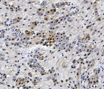 HMGB3 Antibody / HMG4