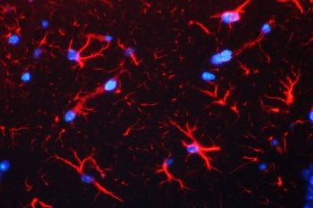 Immunofluorescent staining of FFPE mouse brain with GFAP antibody (red) and DAPI nuclear counterstai