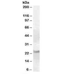 RAB8A Antibody
