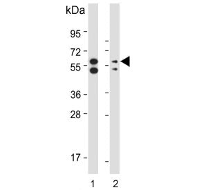 PINK1 Antibody / PARK6