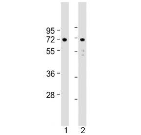 Western blot testing of human 1) U-251 MG and 2) U-87 MG cell lysate with APLP1 antibody at 1:2000. 