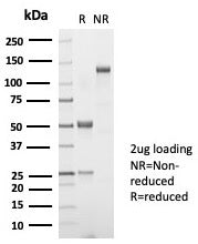 SDS-PAGE analysis of purified, BSA-free recombinant TSH beta antibody (clone TSHb/7001R) as confirma