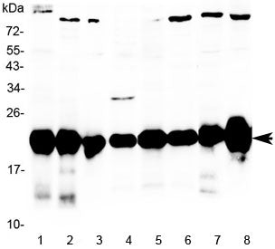 Western blot testing of rat 1) pancreas, 2) kidney, 3) skeletal muscle, 4) liver, 5) testis, 6) hear