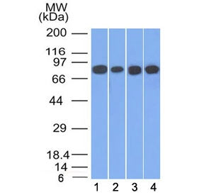 Gamma Catenin Antibody / Plakoglobin
