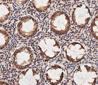 Prohibitin 2 Antibody / PHB2
