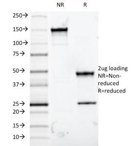 SDS-PAGE Analysis of Purified, BSA-Free MUC5AC Antibody (clone 9-13M1). Confirmation of Integrity an