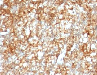 CD147 / Emmprin / Basigin Antibody