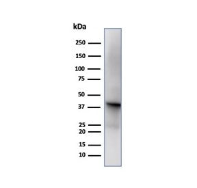 Western blot testing of human liver tissue using GLUL antibody (clone GLUL/6599). Predicted molecula