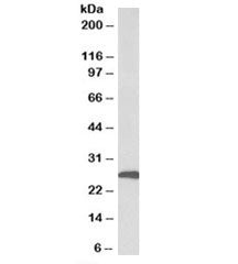 CFD Antibody / Complement Factor D