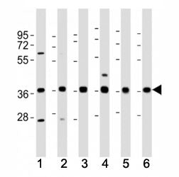 Western blot testing of MICA antibody at 1:2000 dilution. Lane 1: Jurkat lysate; 2: Daudi ; 3: A431;