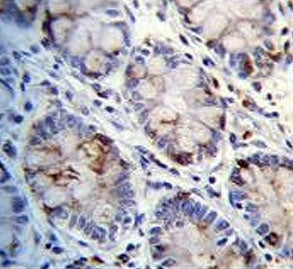 IHC testing of FFPE human rectum tissue with C1QC antibody. HIER: steam section in pH6 citrate buffe