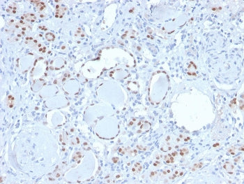 IHC staining of FFPE human kidney with recombinant PAX8 antibody. HIER: boil tissue sections in pH 9