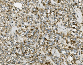 TRIM25 Antibody / EFP