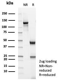 Actin Antibody / Muscle Specific