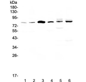 Western blot testing of human 1) HeLa, 2) COLO-320, 3) SK-O-V3, 4) Jurkat, 5) rat heart and 6) mouse heart lysate with CEP68 antibody at 0.5ug/ml. Predicted molecular weight ~81 kDa (isoform 1), ~67 kDa (isoform 2).