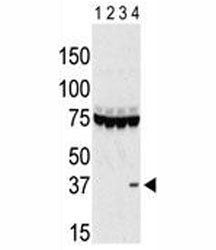 Aurora-C Antibody (AURKC)