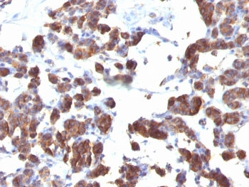 IHC staining of FFPE human thyroid tissue with TG antibody cocktail (clone TGB04 + TGB05). HIER: boi