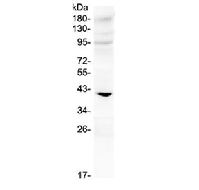Western blot testing of rat heart lysate with IGFBP3 antibody at 0.5ug/ml. Expected molecular weight