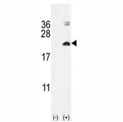Western blot analysis of IL17F antibody and 293 cell lysate (2 ug/lane) either nontransfected (Lane 