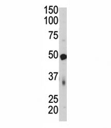PDK4 Antibody