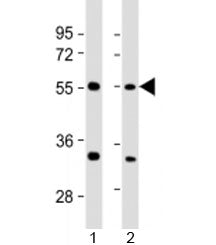 AAAS Antibody / Adracalin