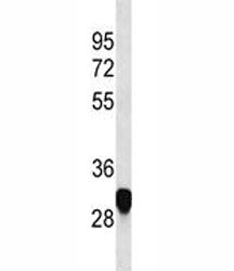 Myelin PLP Antibody