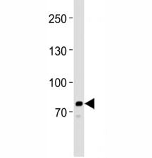 Western blot analysis of lysate from HeLa cell line using anti-PCSK9 antibody at 1:1000. Predicted size: Pro/mature ~74/64 kDa